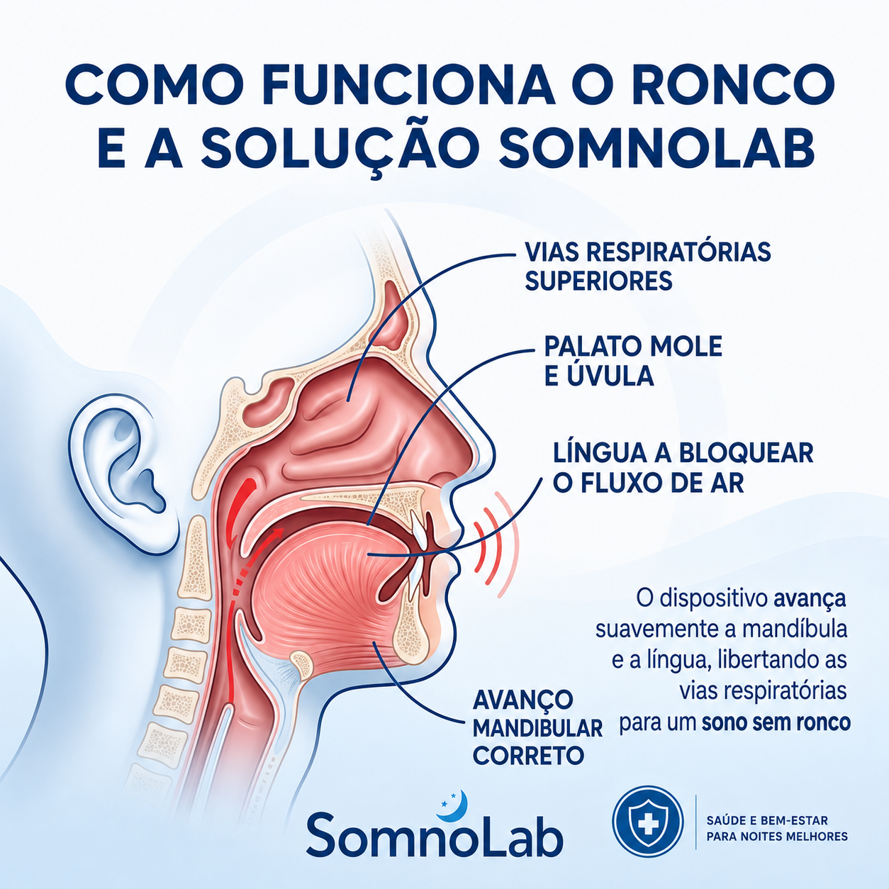 HOJE: 1+1 GRÁTIS! Elimine o ressonar desde a primeira noite – SomnoLab (+ ESTOJO HIGIÉNICO PROTETOR DE OFERTA)